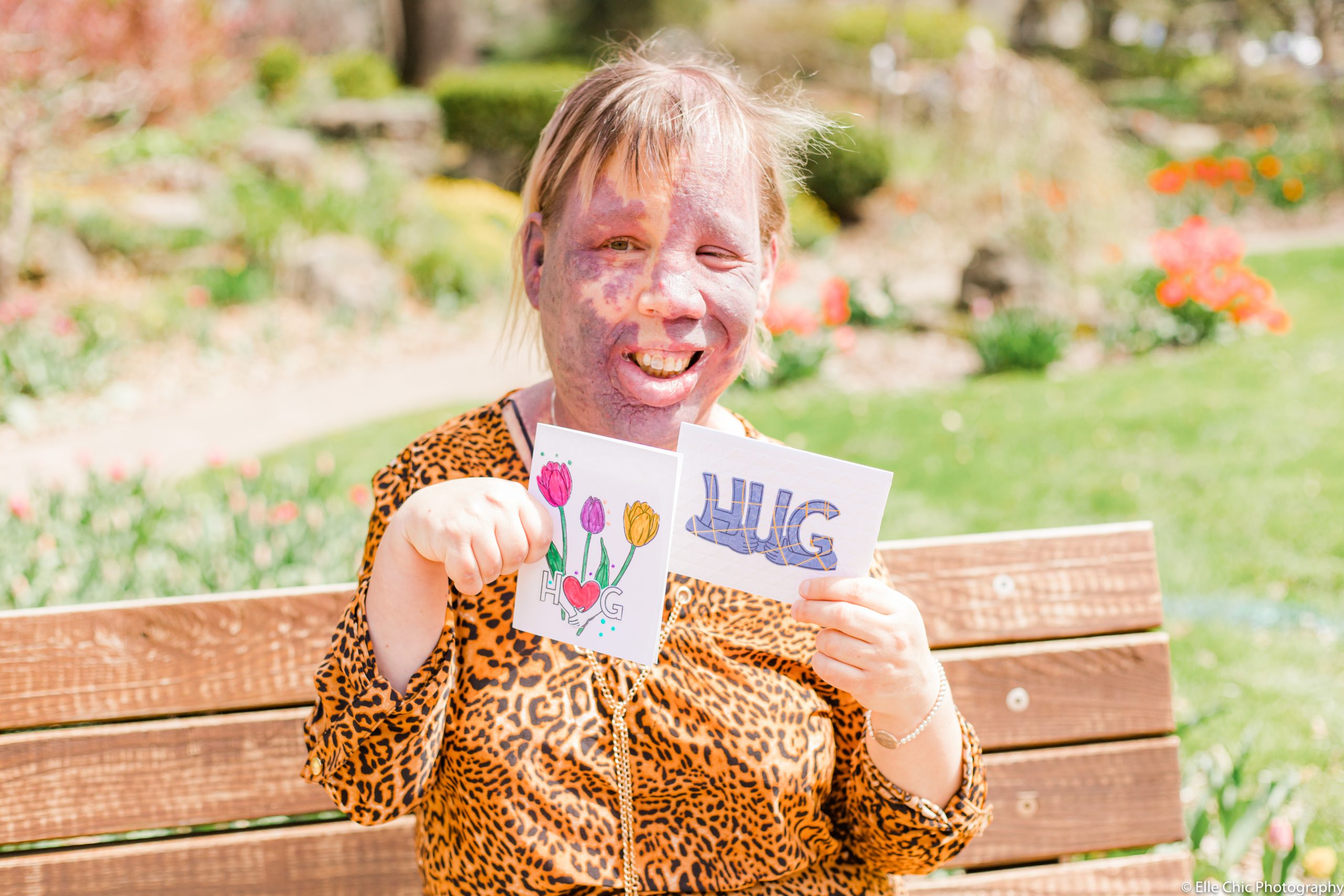 we've got this, photo series, one year later, covid-19, community living guelph wellington, elle chic photography, guelph ontario, disability, frontline heroes, hugs cards, jackie, margo
